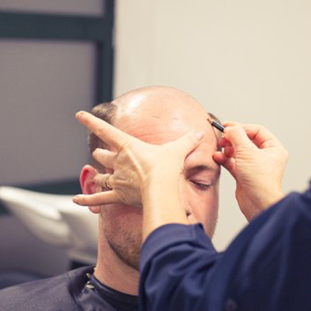 Man waarbij toupet door Just Hair wordt geplaatst